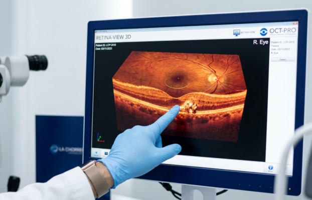 Cuidado de la Retina y la Mácula: Protegiendo el centro de su visión